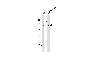 Western blot analysis of lysates from Raji cell line and rat spleen tissue lysate(from left to right), using Mouse Lyn Antibody (Center) (ABIN6243396 and ABIN6577552). (LYN Antikörper  (AA 229-263))
