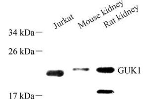 Western blot analysis of GUK1 (ABIN7074153) at dilution of 1: 500 (GUK1 Antikörper)