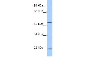 WB Suggested Anti-ZNF485 Antibody Titration:  0. (ZNF485 Antikörper  (N-Term))