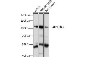 Western blot analysis of extracts of various cell lines, using  Rabbit pAb  at 1:1000 dilution. (ALDH3A2 Antikörper  (AA 250-320))