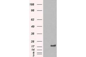 HEK293T cells were transfected with the pCMV6-ENTRY control (Left lane) or pCMV6-ENTRY CRYAB (Right lane) cDNA for 48 hrs and lysed. (CRYAB Antikörper)