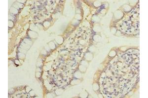 Immunohistochemistry of paraffin-embedded human small intestine tissue using ABIN7158166 at dilution of 1:100