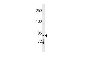 PRICKLE1 Antibody (C-term) (ABIN1537540 and ABIN2850285) western blot analysis in MDA-M cell line lysates (35 μg/lane). (PRICKLE1 Antikörper  (C-Term))