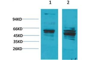 Western Blot (WB) analysis of 1) Mouse Brain Tissue, 2) Rat Brain Tissue with Bombesin Receptor 2 Rabbit Polyclonal Antibody diluted at 1:2000. (Bombesin Receptor 2 Antikörper)