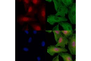 anti-Centrosomal Protein 290kDa (CEP290) (Internal Region) antibody