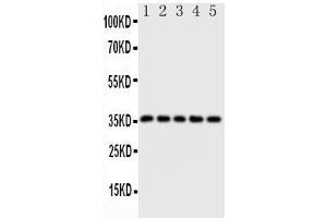 Western Blotting (WB) image for anti-FBJ Murine Osteosarcoma Viral Oncogene Homolog B (FOSB) (AA 1-15), (N-Term) antibody (ABIN3043193)