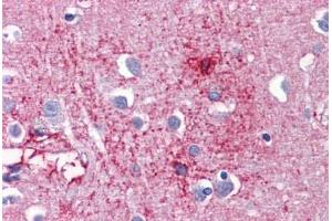 Immunohistochemistry (Formalin-fixed Paraffin-embedded Sections) (IHC (fp)) image for anti-Cadherin 18, Type 2 (CDH18) (AA 467-577) antibody (ABIN574223)