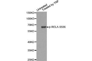 Western blot analysis of extracts from HepG2 cells, using Phospho-RELA-S536 antibody. (NF-kB p65 Antikörper  (pSer536))