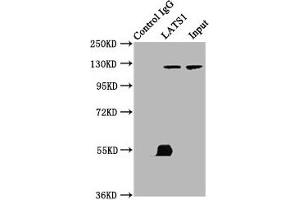 Immunoprecipitating LATS1 in K562 whole cell lysate Lane 1: Rabbit control IgG (1 μg) instead of ABIN7169059 in K562 whole cell lysate. (LATS1 Antikörper  (AA 1-280))