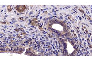 Immunohistochemistry (IHC) image for anti-BCL2-Like 1 (BCL2L1) (AA 2-212) antibody (ABIN7437179)