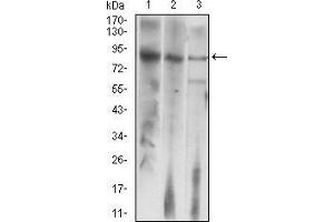 Western blot analysis using LHCGR mouse mAb against HepG2 (1), Jurkat (2), and SMMC-7721 (3) cell lysate. (LHCGR Antikörper)