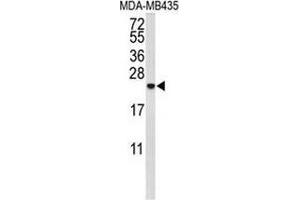 Western blot analysis of IL10 (arrow) in MDA-MB435 cell line lysates (35ug/lane) using Interleukin-10 / IL10 (IL-10 Antikörper  (Middle Region))