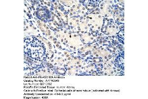 Rabbit Anti-RNASEH2A Antibody  Paraffin Embedded Tissue: Human Kidney Cellular Data: Epithelial cells of renal tubule Antibody Concentration: 4. (RNASEH2A Antikörper  (C-Term))