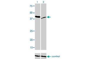 Western blot analysis of RAD23A over-expressed 293 cell line, cotransfected with RAD23A Validated Chimera RNAi (Lane 2) or non-transfected control (Lane 1).