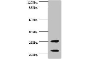 Western blot All lanes: CSRP3 antibody at 1 μg/mL + Mouse skeletal muscle tissue Secondary Goat polyclonal to rabbit IgG at 1/10000 dilution Predicted band size: 21 kDa Observed band size: 21, 25 kDa (CSRP3 Antikörper  (AA 1-194))