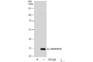 IP Image Immunoprecipitation of Annexin IV protein from HepG2 whole cell extracts using 5 μg of Annexin IV antibody, Western blot analysis was performed using Annexin IV antibody, EasyBlot anti-Rabbit IgG  was used as a secondary reagent. (Annexin IV Antikörper)