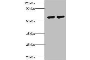 Western blot All lanes: CYP4F12 antibody at 6 μg/mL Lane 1: Mouse small intestine tissue Lane 2: Rat liver tissue Secondary Goat polyclonal to rabbit IgG at 1/10000 dilution Predicted band size: 61, 12 kDa Observed band size: 61 kDa (CYP4F12 Antikörper  (AA 265-524))