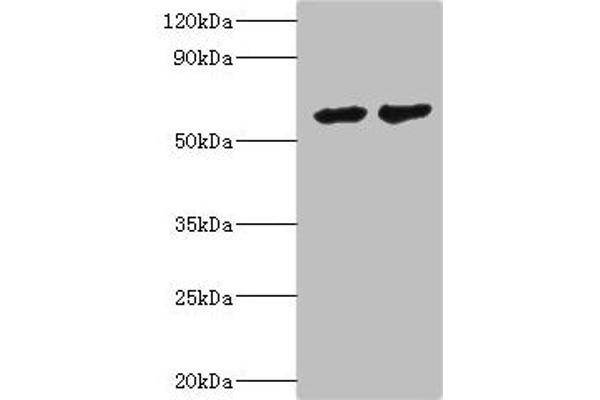 CYP4F12 Antikörper  (AA 265-524)