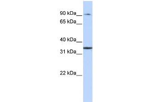 WB Suggested Anti-ZFP90 Antibody Titration: 0. (ZNF90 Antikörper  (Middle Region))