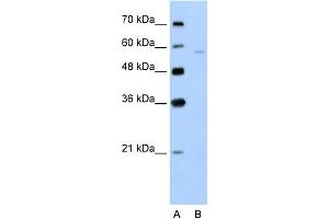 WB Suggested Anti-SLC22A7 Antibody Titration:  5. (SLC22A7 Antikörper  (N-Term))