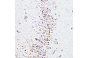 Immunohistochemistry of paraffin-embedded rat brain using SIRT4 Rabbit pAb (ABIN6129330, ABIN6147796, ABIN6147797 and ABIN6223494) at dilution of 1:100 (40x lens).