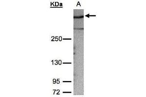 WB Image Sample (30μg whole cell lysate) A:HeLa S3, 5% SDS PAGE antibody diluted at 1:1000 (AKAP12 Antikörper  (C-Term))