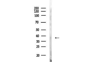 anti-Ubiquitin Specific Peptidase 18 (USP18) (N-Term) antibody