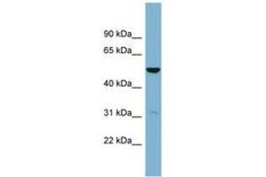 Image no. 1 for anti-Serine Dehydratase-Like (SDSL) (C-Term) antibody (ABIN6743388) (SDSL Antikörper  (C-Term))