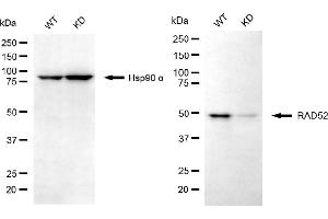 anti-RAD52 Homolog (S. Cerevisiae) (RAD52) antibody