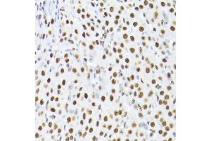Immunohistochemistry of paraffin-embedded rat ovary using K/K/TRIM28 Rabbit pAb  at dilution of 1:200 (40x lens).
