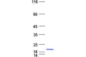 Western Blotting (WB) image for S100 Calcium Binding Protein A9 (S100A9) protein (His tag) (ABIN2731329)