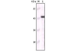 Western blot analysis using CK5 mouse mAb against truncated CK5 recombinant protein (Cytokeratin 5 Antikörper)