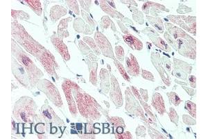 Detection of MYLK3 in Human Heart Tissue using Polyclonal Antibody to Myosin Light Chain Kinase 3 (MYLK3) (MYLK3 Antikörper  (AA 555-786))