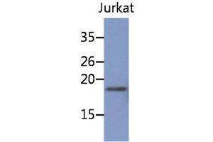 The cell lysate of Jurkat (30ug) were resolved by SDS-PAGE, transferred to PVDF membrane and probed with anti-human NBL1 antibody (1:1000). (NBL1 Antikörper)