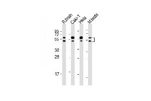 All lanes : Anti-CDKL3 Antibody (N-Term) at 1:2000 dilution Lane 1: rat brain lysates Lane 2: Caki-1 whole cell lysates Lane 3: Hela whole cell lysates Lane 4: mouse testis lysates Lysates/proteins at 20 μg per lane. (CDKL3 Antikörper  (AA 2-34))