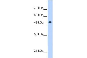 WB Suggested Anti-PNPLA3 Antibody Titration:  1 ug/ml  Positive Control:  Jurkat cell lysate
