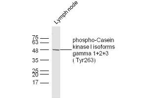 Mouse lymph node lysates probed with Casein kinase I isoforms gamma 1+2+3 (Tyr263) Polyclonal Antibody, unconjugated  at 1:300 overnight at 4°C followed by a conjugated secondary antibody at 1:10000 for 60 minutes at 37°C. (CSNK1G1, CSNK1G2, CSNK1G3 (pTyr263) Antikörper)