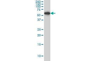 HDAC1 monoclonal antibody (M06), clone 1D6 Western Blot analysis of HDAC1 expression in Hela S3 NE . (HDAC1 Antikörper  (AA 1-482))
