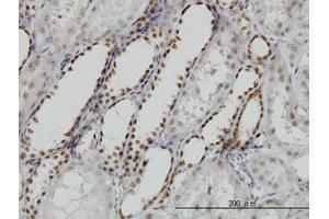 Image no. 5 for anti-Decapping Enzyme, Scavenger (DCPS) (AA 1-338) antibody (ABIN599227) (DCPS Antikörper  (AA 1-338))