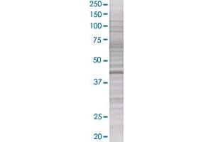 SPHK1 transfected lysate. (SPHK1 293T Cell Transient Overexpression Lysate(Denatured))