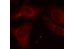 Immunofluorescence staining of methanol-fixed Hela cells using Phospho-NFKB1-S927 antibody. (NFKB1 Antikörper  (pSer927))