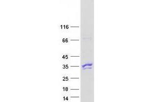 Western Blotting (WB) image for Vav 3 Oncogene (VAV3) (Transcript Variant 2) protein (Myc-DYKDDDDK Tag) (ABIN2735200)