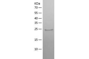 Western Blotting (WB) image for Thiamin Pyrophosphokinase 1 (TPK1) (AA 1-243) protein (His tag) (ABIN7125352) (TPK1 Protein (AA 1-243) (His tag))