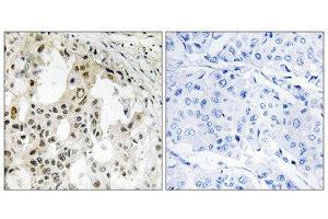 Immunohistochemistry (IHC) image for anti-Eukaryotic Translation Initiation Factor 3, Subunit D (EIF3D) (Internal Region) antibody (ABIN1851320) (EIF3D Antikörper  (Internal Region))