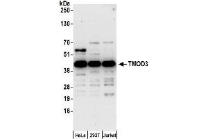 anti-Tropomodulin 3 (TMOD3) (AA 302-352) antibody