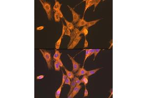 Immunofluorescence analysis of NIH/3T3 cells using PFKL antibody (ABIN7269308) at dilution of 1:100. (PFKL Antikörper  (AA 700-780))