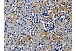 ABIN7097157 and ABIN7101225 at 1/100 staining mouse kidney tissue by IHC-P.