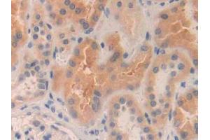 DAB staining on IHC-P; Samples: Human Kidney Tissue (MMP24 Antikörper  (AA 429-642))