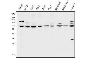 Western blot analysis of CLPB using anti-CLPB antibody (ABIN7601732).