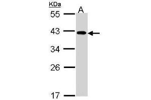 anti-eIF2B beta (Center) antibody